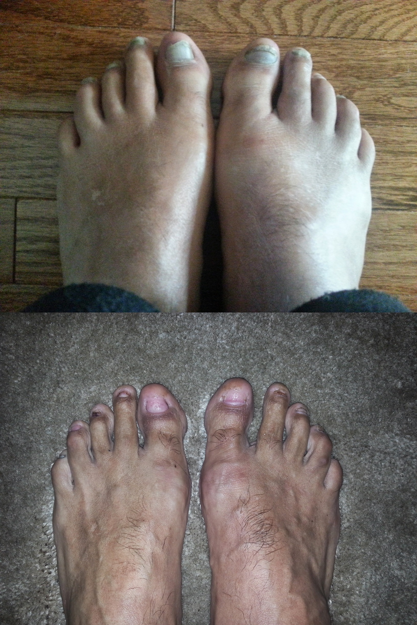 Antes y desués